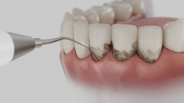 Trusted Dental Implants service in Weston Lakes, TX - Dentist Open Now